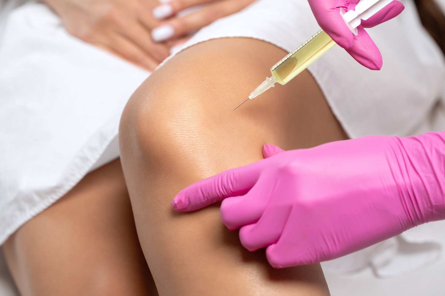 PRP Therapy for Knee Osteoarthritis