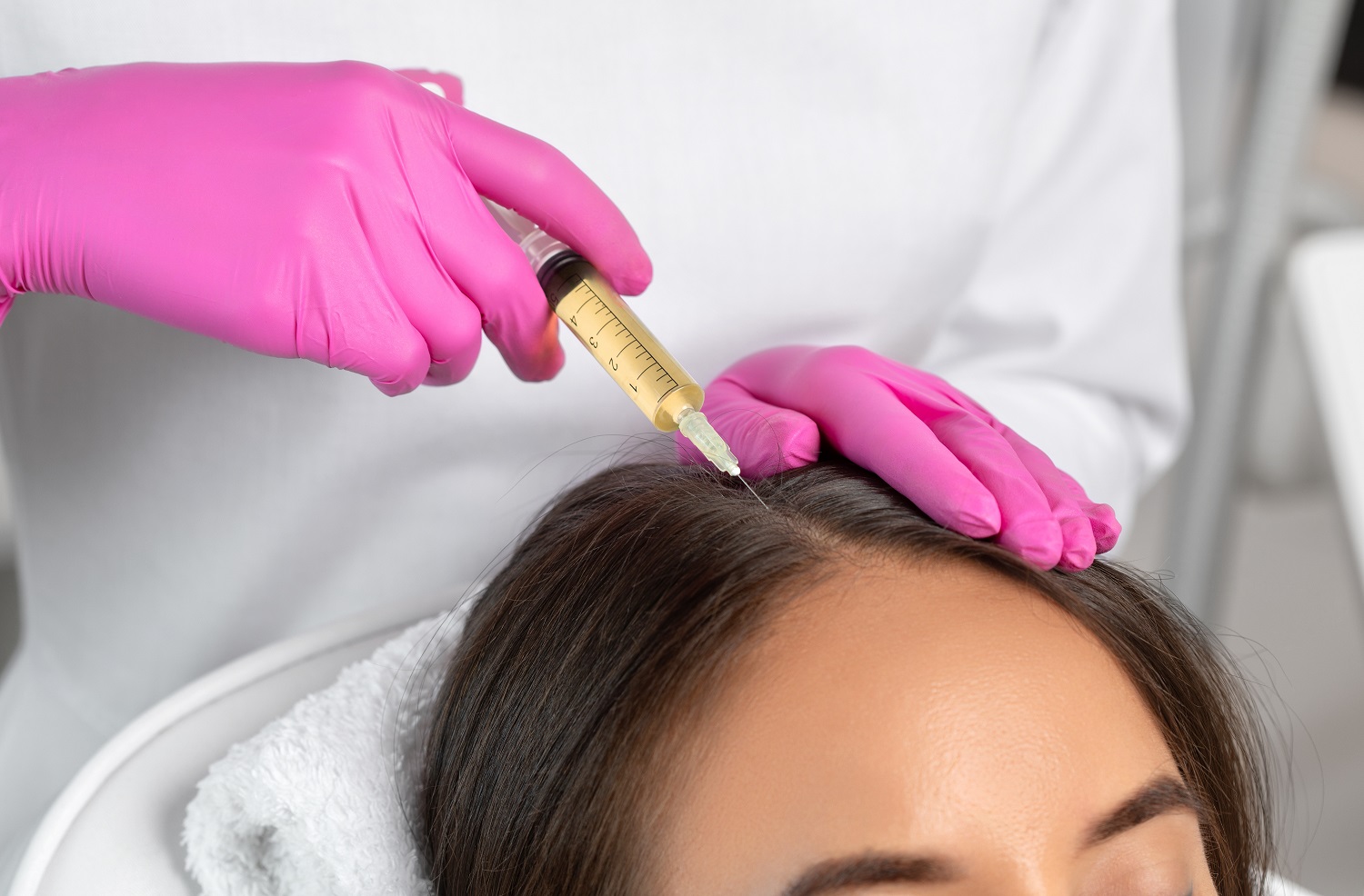 Cosmetologist does prp therapy against hair loss and anti-dandru