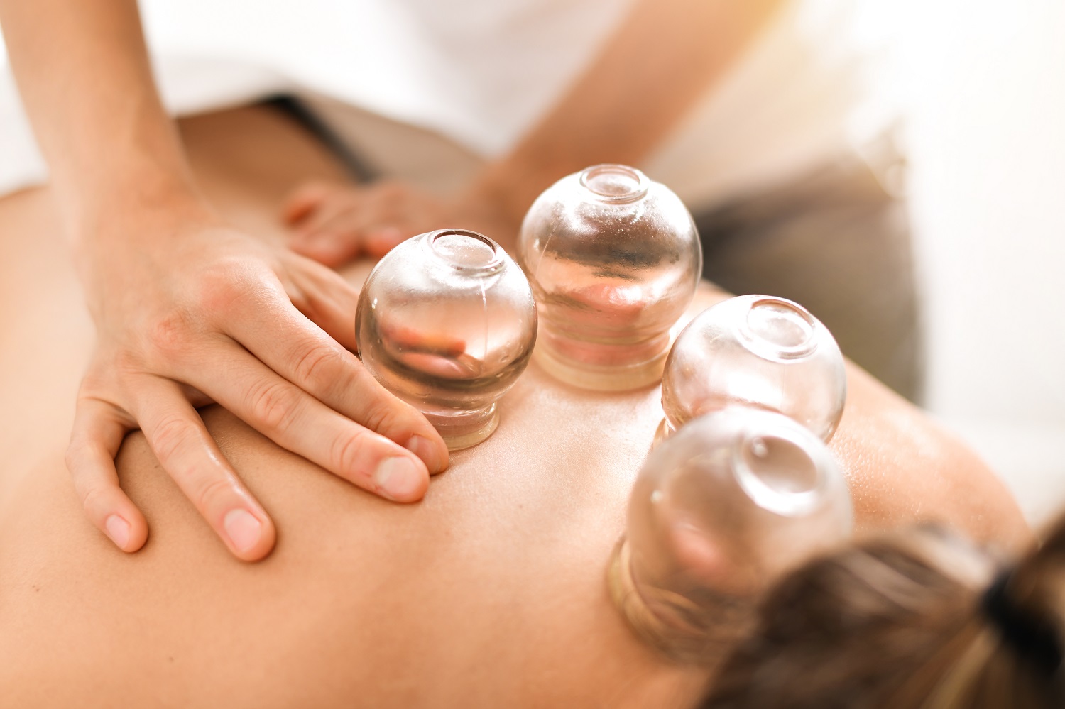 Cupping Therapy in Scottsdale, AZ | Source of Health