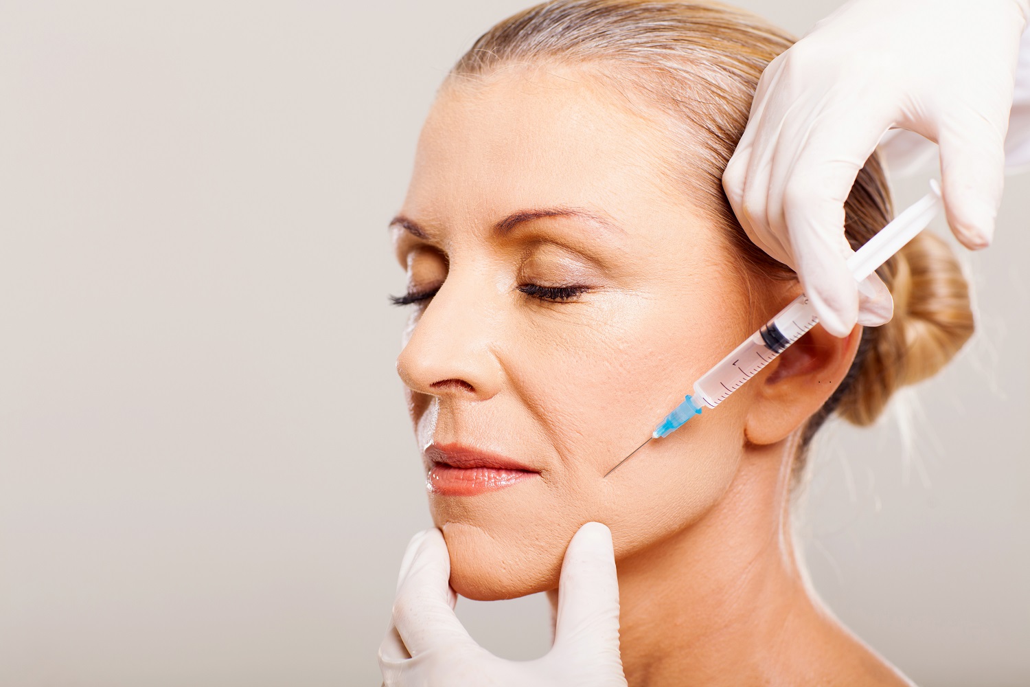 Facelifting | Senior Woman